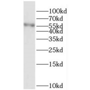 WB analysis of human brain tissue, using PRCP antibody (1/400 dilution).