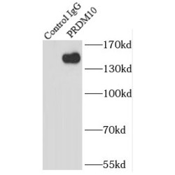 PR/SET Domain 10 (PRDM10) Antibody