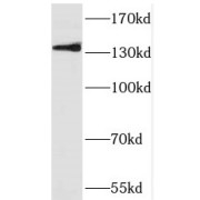 WB analysis of HEK-293 cells, using PRDM10 antibody (1/1000 dilution).