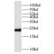 WB analysis of MCF7 cells, using PRDX1 antibody (1/1000 dilution).