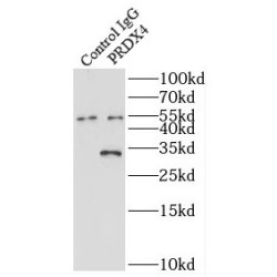 Peroxiredoxin 4 (PRDX4) Antibody