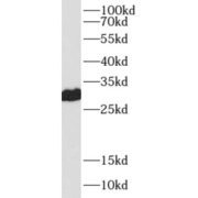 WB analysis of K-562 cells, using PRDX4 antibody (1/1000 dilution).