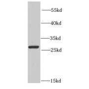 WB analysis of A549 cells, using PRDX6 antibody (1/1000 dilution).