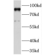 WB analysis of mouse brain tissue, using PRICKLE1 antibody (1/1000 dilution).