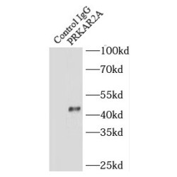 Protein Kinase cAMP-Dependent Type II Regulatory Subunit Alpha (PRKAR2A) Antibody