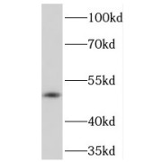 WB analysis of K-562 cells, using PRKAR2A antibody (1/1000 dilution).