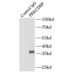 Protein Kinase C Delta-Binding Protein (PRKCDBP) Antibody