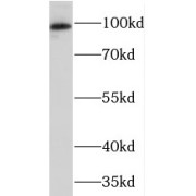 WB analysis of human brain tissue, using PRKD2 antibody (1/500 dilution).