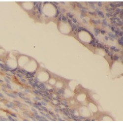 Protein Kinase, CGMP-Dependent, Type II (PRKG2) Antibody