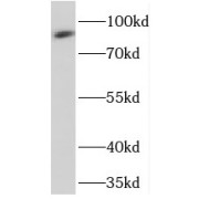 WB analysis of mouse brain tissue, using PRKG2 antibody (1/500 dilution).