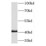WB analysis of Jurkat cells, using PRKX antibody (1/500 dilution).