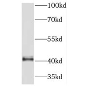 WB analysis of A549 cells, using PRMT1 antibody (1/600 dilution).