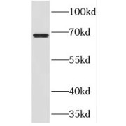 WB analysis of human liver tissue, using PRMT3 antibody (1/600 dilution).