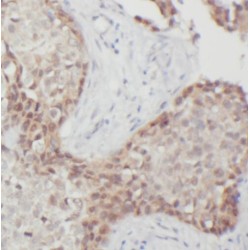 Protein Arginine Methyltransferase 6 (PRMT6) Antibody