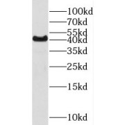 WB analysis of human brain tissue, using PRMT6 antibody (1/500 dilution).