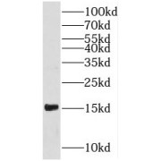 WB analysis of human brain tissue, using PFN1 antibody (1/500 dilution).