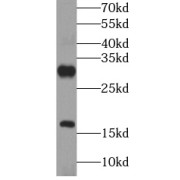 WB analysis of PC-3 cells, using proGRP antibody (1/1000 dilution).