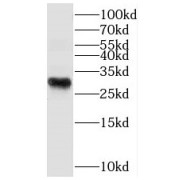 WB analysis of L02 cells, using PROSC antibody (1/3000 dilution).