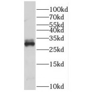 WB analysis of mouse brain tissue, using PrP antibody (1/1000 dilution).