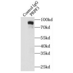 Pre-mRNA Processing Factor 3 (PRPF3) Antibody