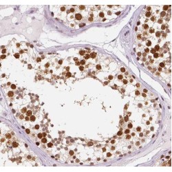 Pre-mRNA Processing Factor 39 (PRPF39) Antibody