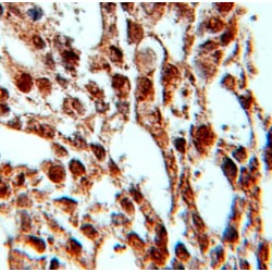 Pre-mRNA Processing Factor 4 (PRPF4) Antibody