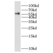 WB analysis of Raji cells, using PRPF4 antibody (1/500 dilution).