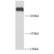 WB analysis of HeLa cells, using PRPF8 antibody (1/1000 dilution).