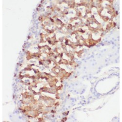 Phosphoribosyl Pyrophosphate Synthetase Associated Protein 2 (PRPSAP2) Antibody