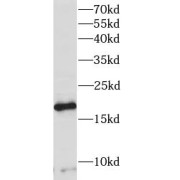 WB analysis of MCF-7 cells, using PRR13 antibody (1/300 dilution).