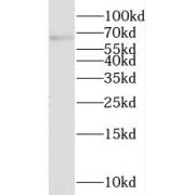 WB analysis of MCF-7 cells, using PRR14 antibody (1/1000 dilution).