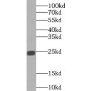 WB analysis of Transfected HEK-293 cells, using PRR4 antibody (1/1000 dilution).