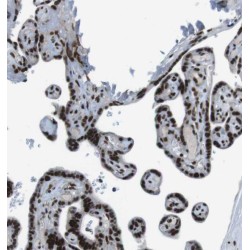 Proline Rich 5 (PRR5) Antibody