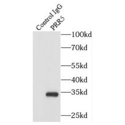 Proline Rich 5 (PRR5) Antibody