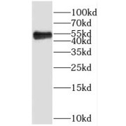 WB analysis of human kidney tissue, using PRR5 antibody (1/500 dilution).