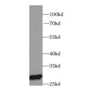 WB analysis of MCF-7 cells, using PRX3 antibody (1/1000 dilution).