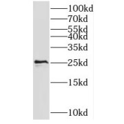 WB analysis of Jurkat cells, using PSF2 antibody (1/2000 dilution).