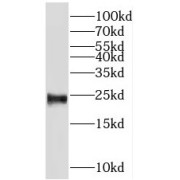 WB analysis of mouse uterus tissue, using PSG11 antibody (1/600 dilution).