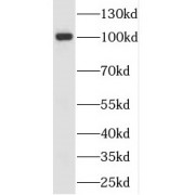 WB analysis of human liver tissue, using FOLH1 antibody (1/500 dilution).