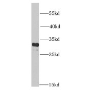 WB analysis of HeLa cells, using PMSA4 antibody (1/1000 dilution).