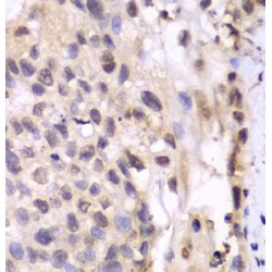 Proteasome Subunit Alpha Type 6 (PSMA6) Antibody