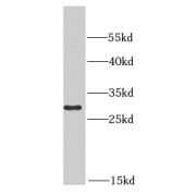 WB analysis of MCF7 cells, using PSMA6 antibody (1/1000 dilution).