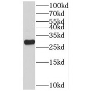 WB analysis of HeLa cells, using PSMA7 antibody (1/1000 dilution).