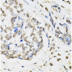 Proteasome Subunit Beta Type 1 (PSMB1) Antibody