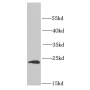 WB analysis of HeLa cells, using PSMB1 antibody (1/1000 dilution).