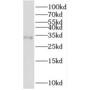 WB analysis of Jurkat cells, using PSMB11 antibody (1/300 dilution).