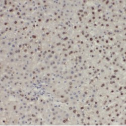 Proteasome Subunit Beta Type 3 (PSMB3) Antibody