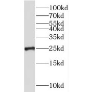 WB analysis of HeLa cells, using PSMB3 antibody (1/200 dilution).