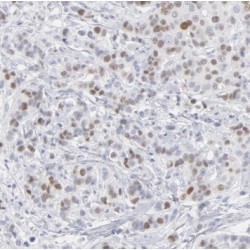 Proteasome Subunit Beta Type 4 (PSMB4) Antibody