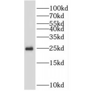 WB analysis of HEK-293 cells, using PSMB4 antibody (1/600 dilution).